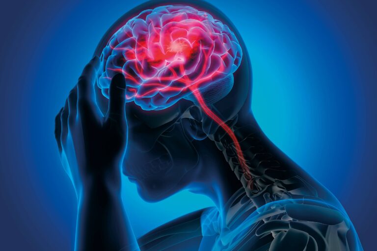 Ma van a sztrók világnapja – a gyors felismerés életet menthet!