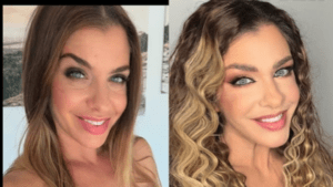 Szépen gyógyul Dér Heni arca a műtét után + videó